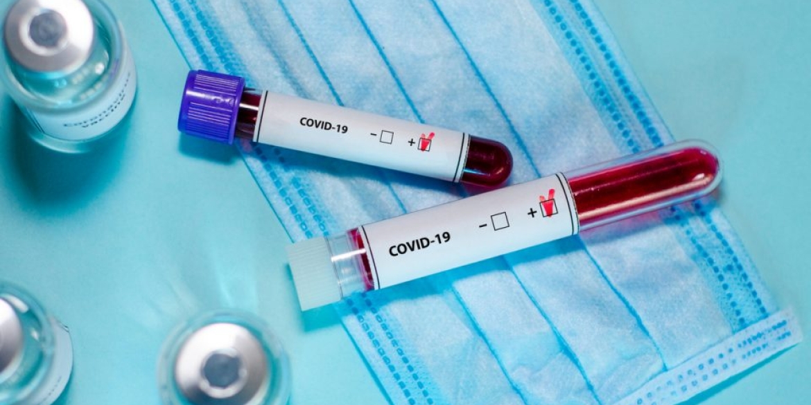 За добу 21 пацієнт повторно отримав позитивний тест на COVID-19