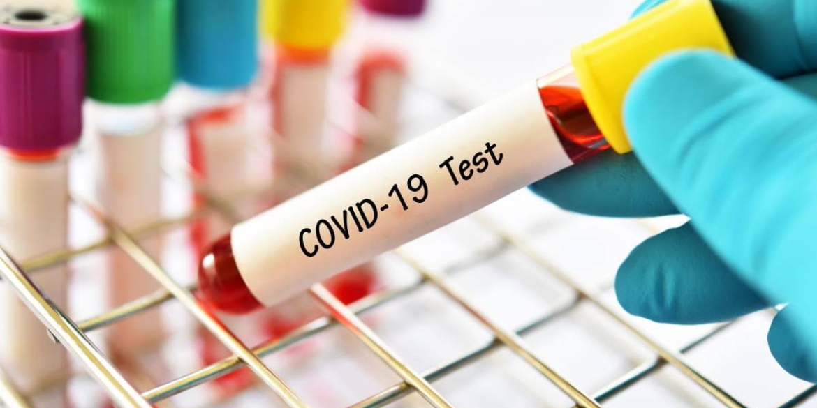 Безкоштовний тест на COVID-19 - куди звертатись вінничанам