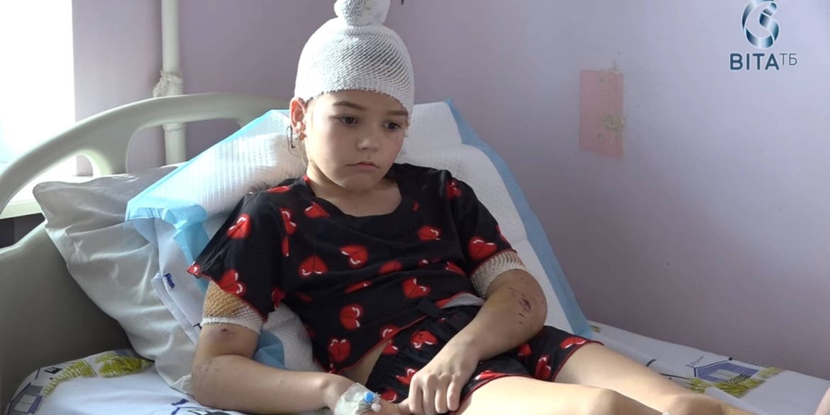 Десятки ран, часткова ампутація вуха наслідки нападу собак на 11-річну дівчинку на Вінниччині