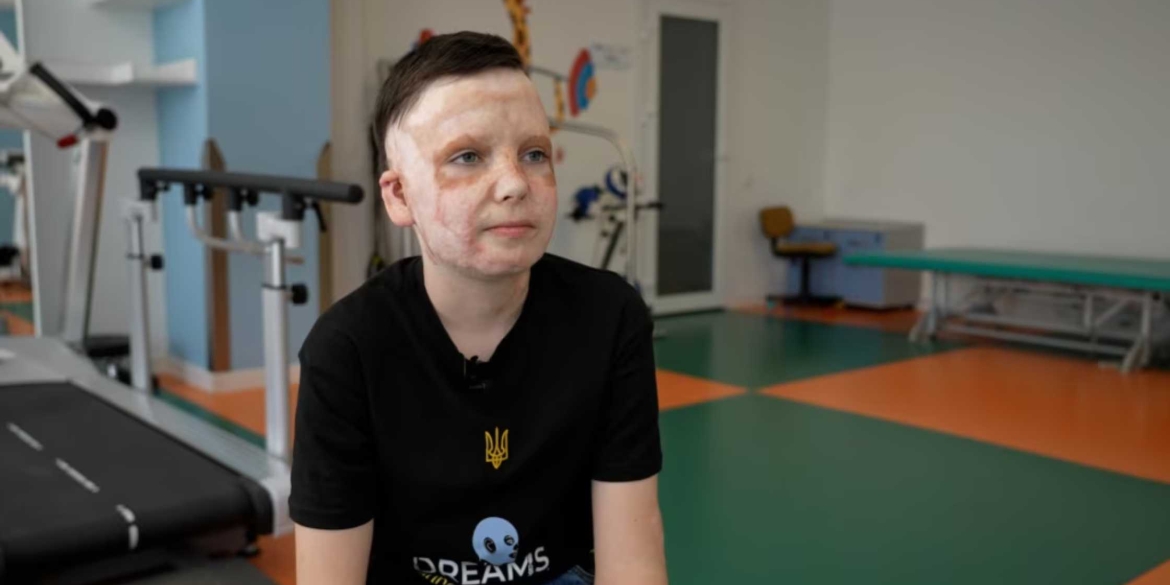 Історія Романа Олексіва, який вижив після ракетного удару по Вінниці