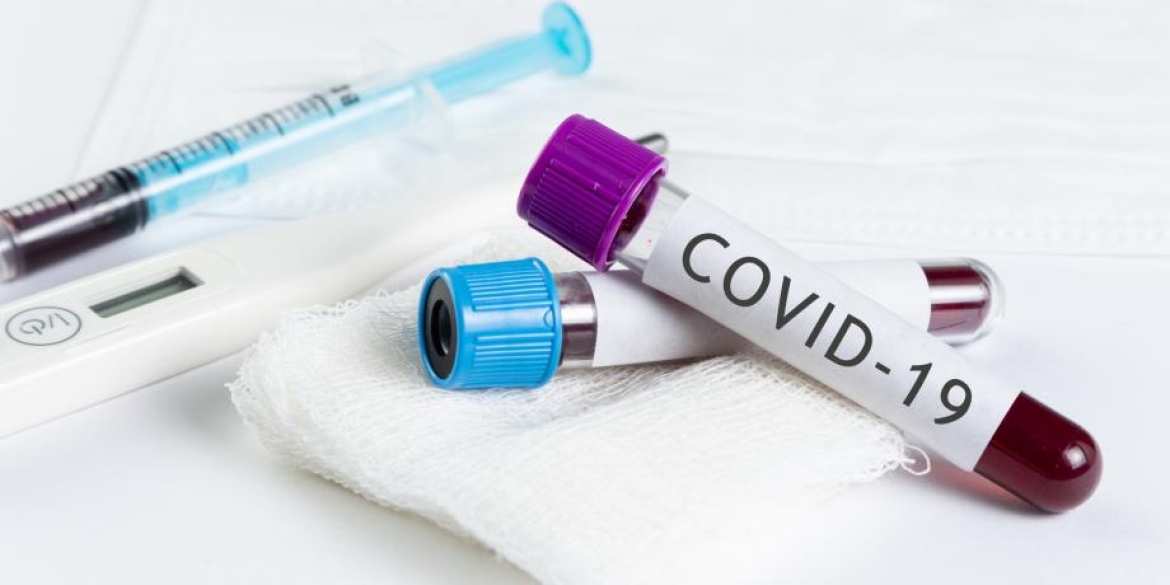 325 нових випадків за добу та 6 смертей: COVID-19 набирає обертів