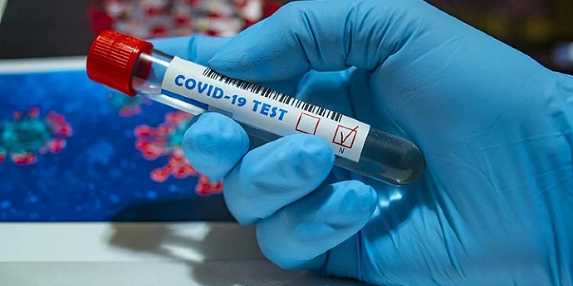 COVID-19: на Вінниччині станом на 30 січня хворіє 15 575 осіб