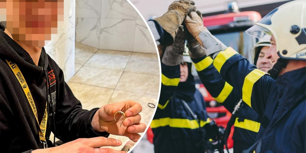 Прикраса стала загрозою у Вінниці бійці ДСНС розрізали перстень прямо на руці постраждалого