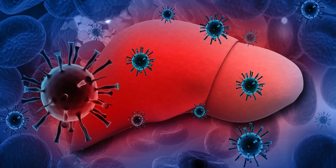 Спалах гепатиту А у Вінниці - чи встановили джерело зараження?