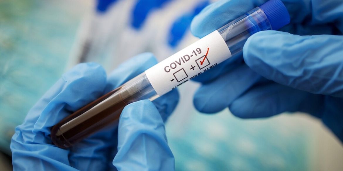 Станом на 11 листопада на Вінниччині 1 287 людей хворіють на коронавірус