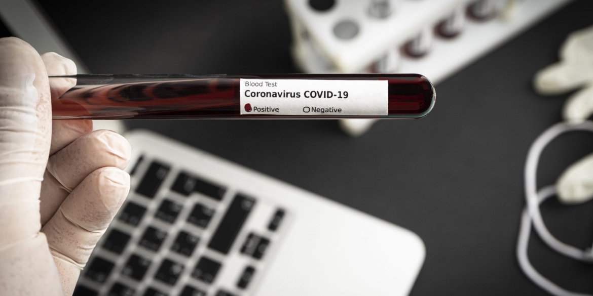 Станом на 8 грудня на Вінниччині 916 людей хворіють на коронавірус