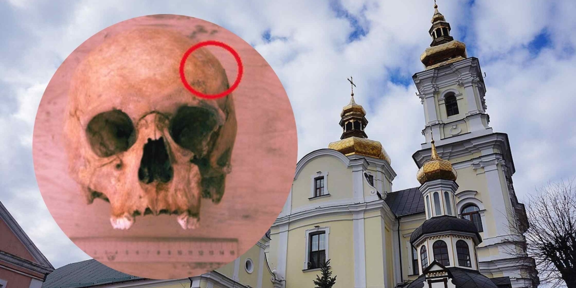 У Вінниці археологи зробили унікальну знахідку стародавній череп зі слідами трепанації