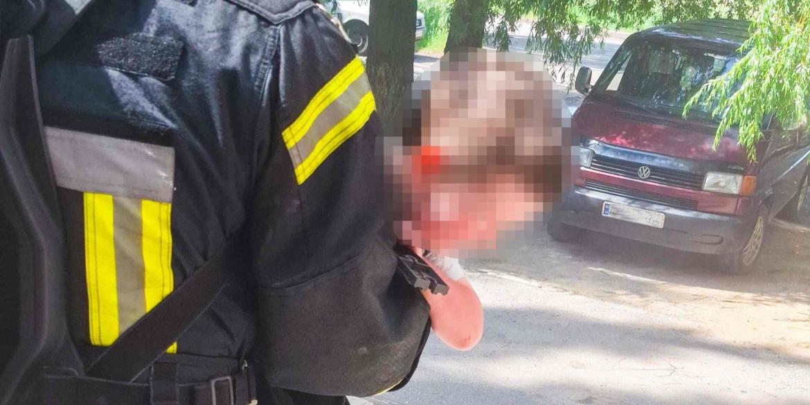 У Вінниці горіло в багатоповерхівці дворічна дитина потрапила у лікарню