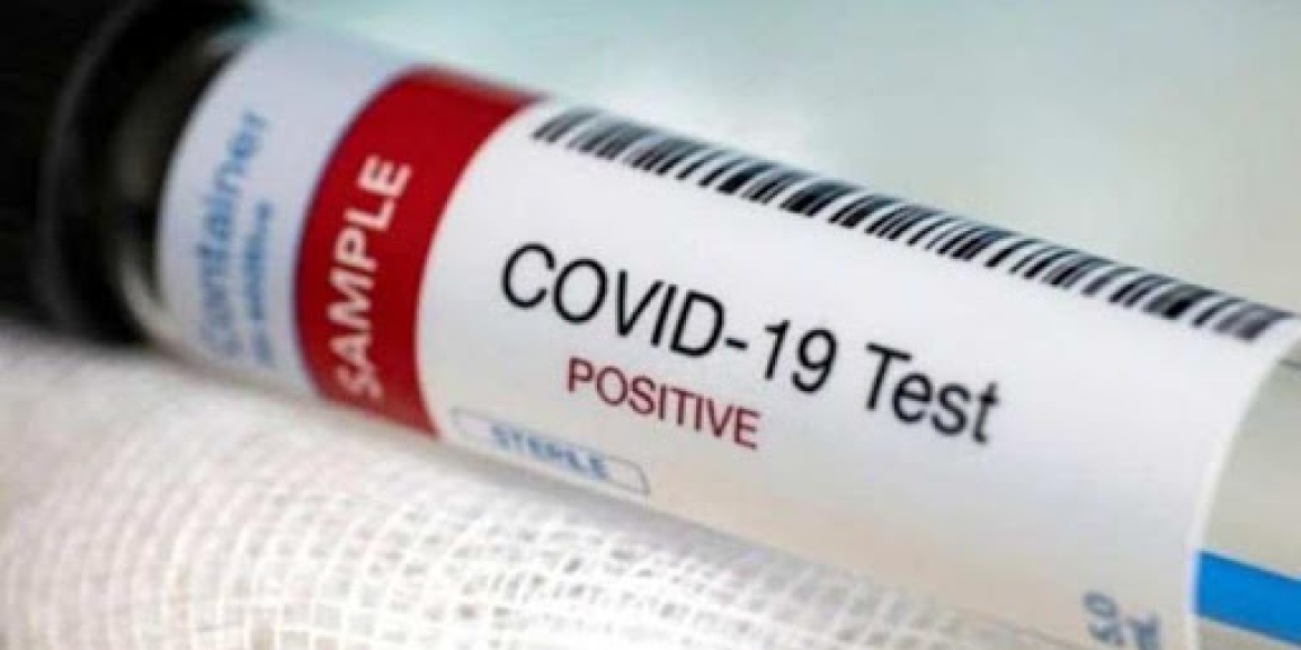 За добу COVID-19 повторно виявили у 33 вінничан