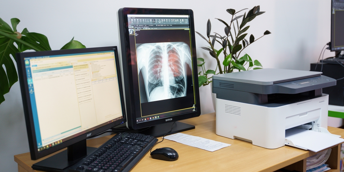 Вінницька лікарня швидкої допомоги отримала сучасний рентген-монітор