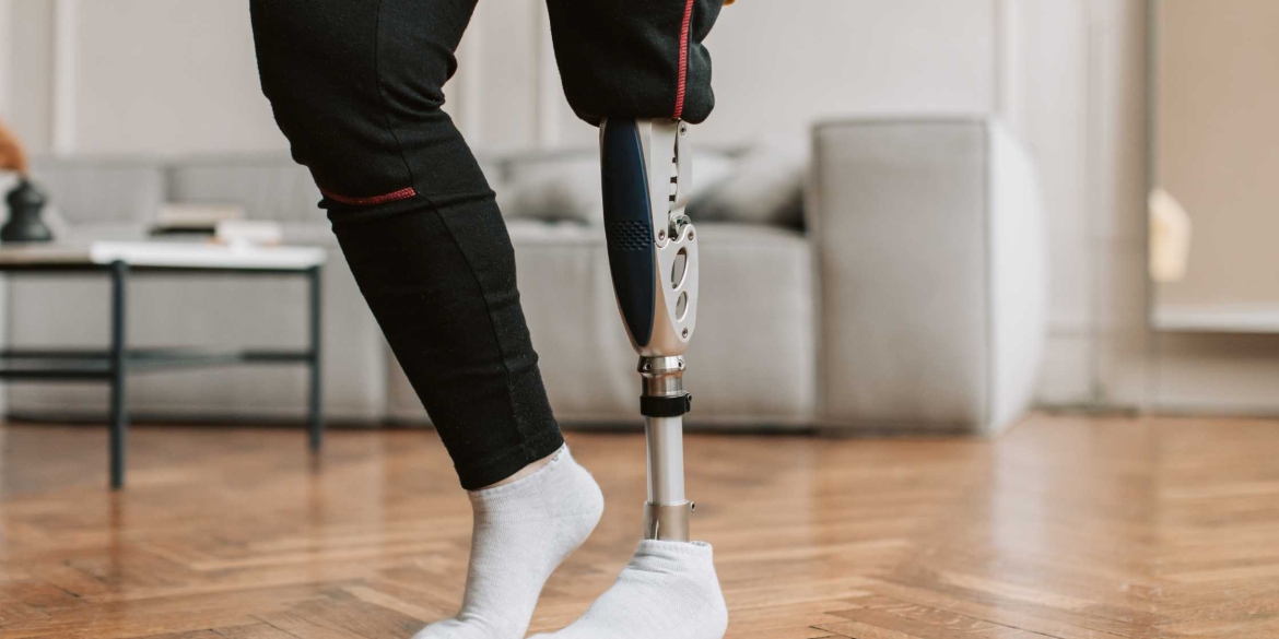 Вінницькі воїни з ампутованими кінцівками можуть отримати компенсацію за лікування