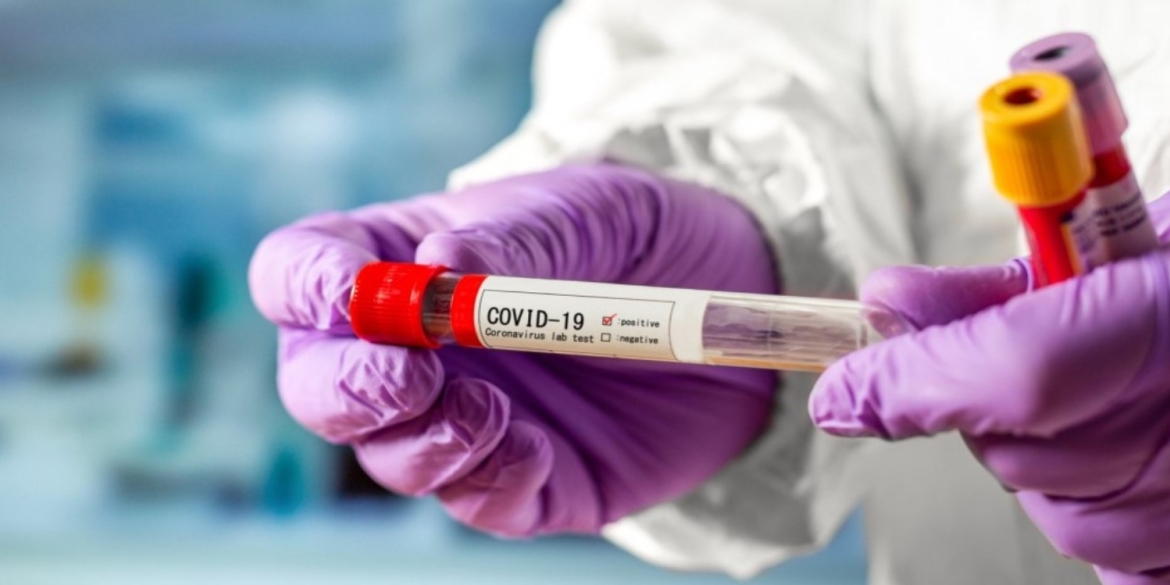 За добу 28 грудня на Вінниччині зафіксовано 161 новий випадок COVID-19