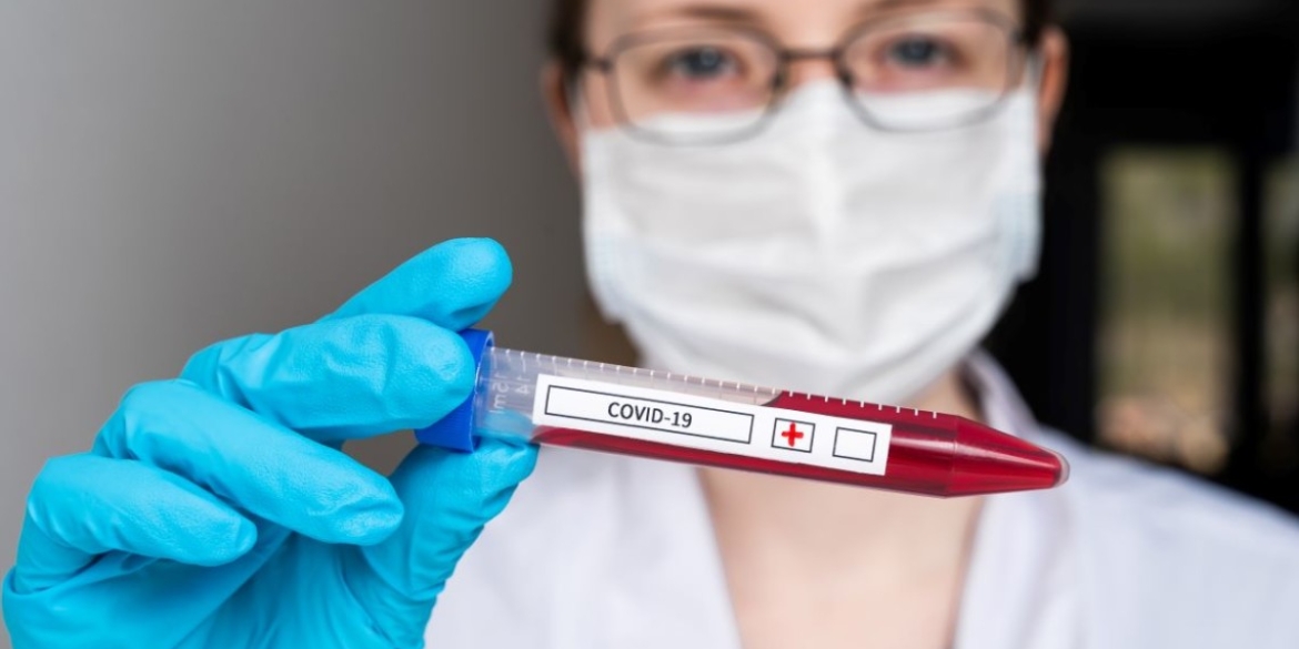 За добу, 31 серпня, на Вінниччині коронавірус підтвердили у 269 людей