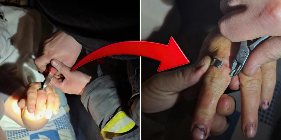 Замість каблучки — шайба вінницькі рятувальники визволяли жінку з металевого «полону»