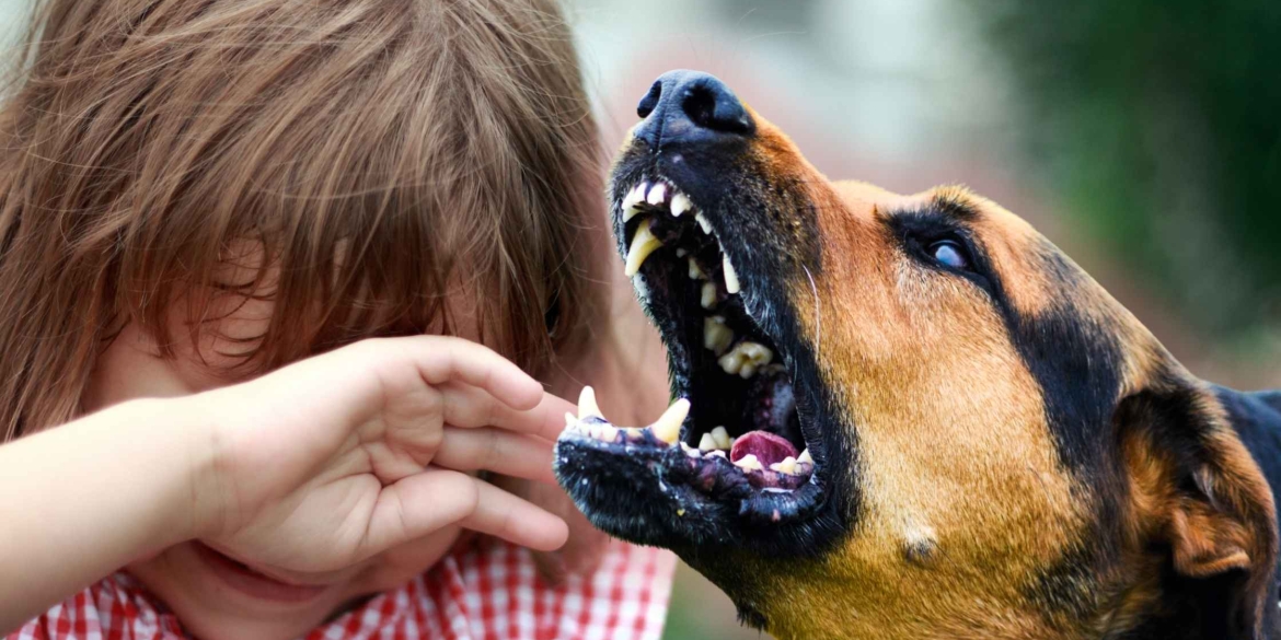 Зграя собак на Вінниччині ледь не роздерла 11-річну дівчинку