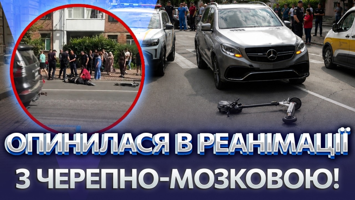 Embedded thumbnail for Водійку електросамоката госпіталізували в реанімацію після ДТП у Вінниці