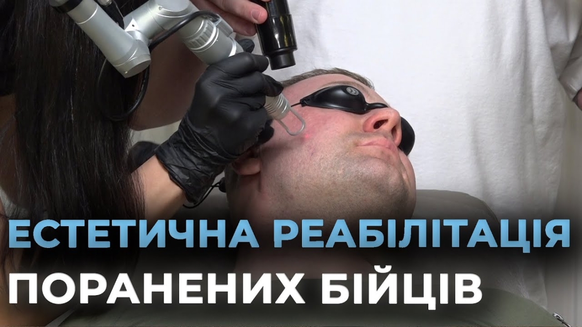 Embedded thumbnail for У Вінниці безкоштовно виводять травматичний татуаж бійцям