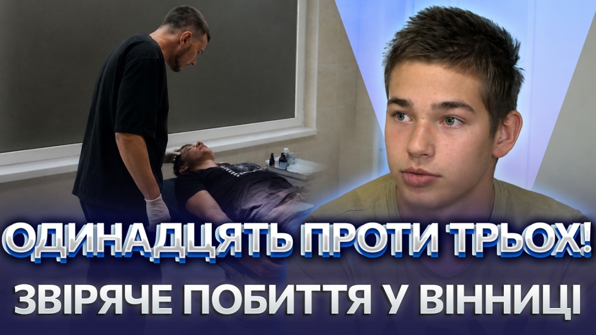 Embedded thumbnail for 16-річного вінничанина госпіталізували після нападу агресивної компанії з 11 осіб