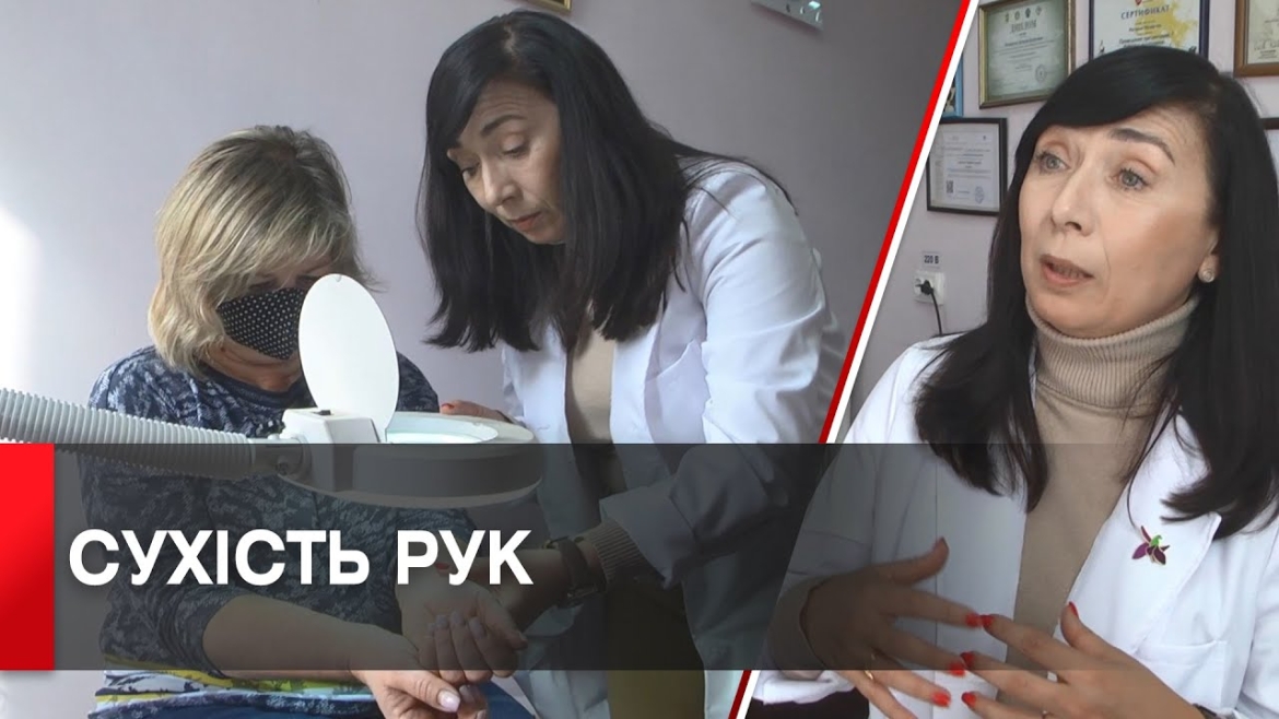 Embedded thumbnail for Ні сухості шкіри: як зберегти руки у холоди