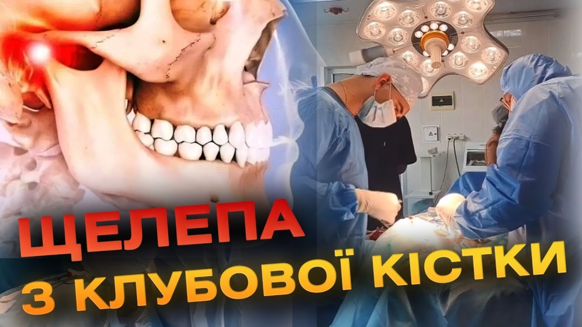Embedded thumbnail for У Вінниці в лікарні ім. Пирогова провели унікальну операцію на обличчі