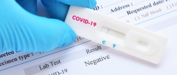 У Вінницькій області за добу зафіксовано 446 випадків COVID-19