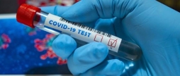 За добу на COVID-19 занедужав 271 мешканець Вінницької області