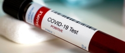 +202 випадки та 4 смерті за добу:  COVID-19 набирає обертів
