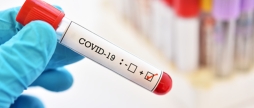 COVID-19: на Вінниччині за попередню добу зафіксували 122 нових випадки