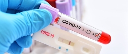 COVID-19: на Вінниччині впродовж останньої доби одужали 68 людей 