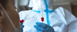 Минулої доби на COVID-19 захворіли 11 мешканців Вінниччини