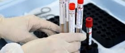 У Вінниці спостерігається стабілізація поширення COVID-19