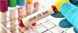Безкоштовний тест на COVID-19 - куди звертатись вінничанам