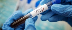 COVID-19 на Вінниччині станом на 9 грудня хворіє 14 565 осіб