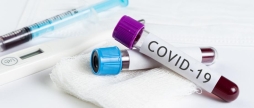 325 нових випадків за добу та 6 смертей: COVID-19 набирає обертів