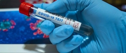 На Вінниччині за добу зафіксували 13 смертей та 816 нових випадків COVID-19