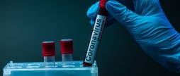 У Вінниці стабілізувалась динаміка поширення COVID-19