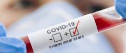 За добу COVID-19 виявили у 70 вінничан