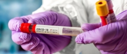 COVID-19: на Вінниччині станом на 22 грудня хворіє 9 603 особи