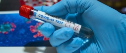 Станом на 20 грудня на Вінниччині 942 людини хворіють на коронавірус
