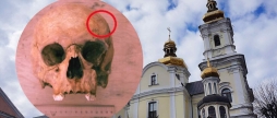У Вінниці археологи зробили унікальну знахідку стародавній череп зі слідами трепанації