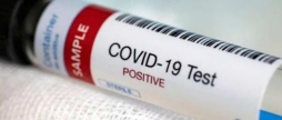 COVID-19: на Вінниччині за добу +36 нових випадків