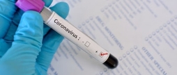 На Вінниччині за добу COVID-19 виявили у двох людей
