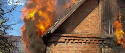 Вінничанин намагався врятувати своє майно з вогню й потрапив з опіками до лікарні