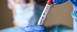 За добу, 29 грудня, на Вінниччині 32 людини захворіли на коронавірус
