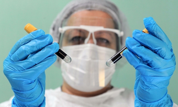 За минулу добу на COVID-19 захворіли 22 мешканці Вінниччини