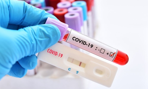 COVID-19: на Вінниччині впродовж останньої доби одужали 68 людей 