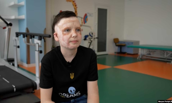 Історія Романа Олексіва, який вижив після ракетного удару по Вінниці