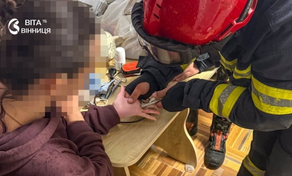 Не знімається каблучка У Вінниці рятувальники знають, як допомогти Не знімається каблучка У Вінниці рятувальники знають, як допомогти