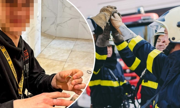 Прикраса стала загрозою у Вінниці бійці ДСНС розрізали перстень прямо на руці постраждалого