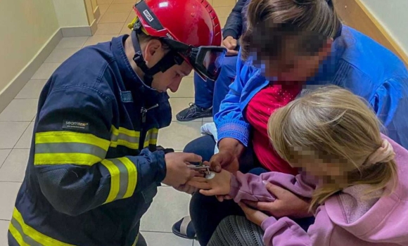 Рятувальники допомогли 10-річній вінничанці зняти металеву шайбу з пальця